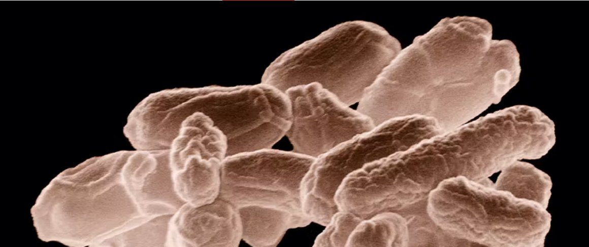 ¿Qué enfermedades pueden provocar la muerte debido a las bacterias multirresistentes?
