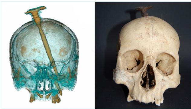 Una investigación cuestiona la teoría de que las cabezas cortadas íberas eran solo de guerreros