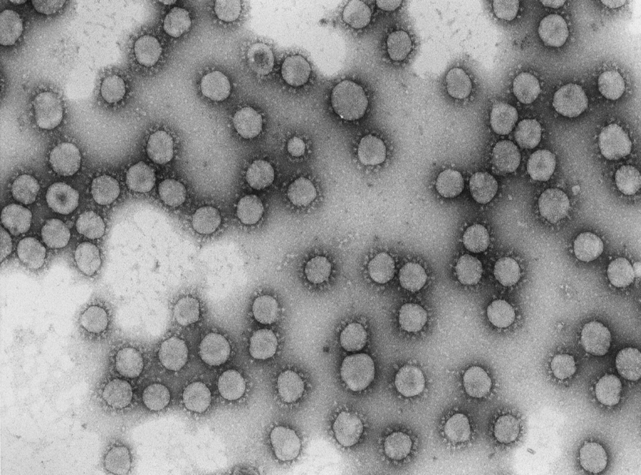 SeqCOVID, proyecto del CSIC, busca responder a cómo llegó y se expandió el coronavirus en España