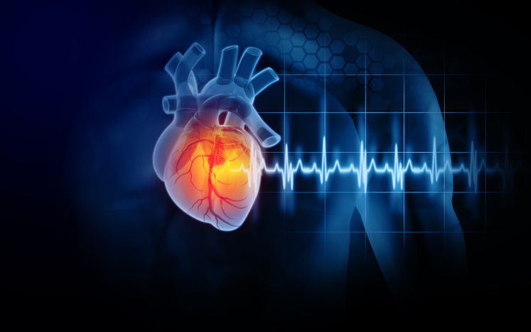 La mortalidad por un primer infarto es un 20 por ciento superior en una mujer que en un hombre