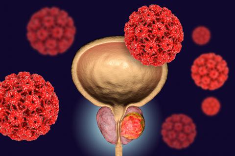 Una investigación en Sevilla trabaja en detectar en segundos con inteligencia artificial el cáncer de próstata