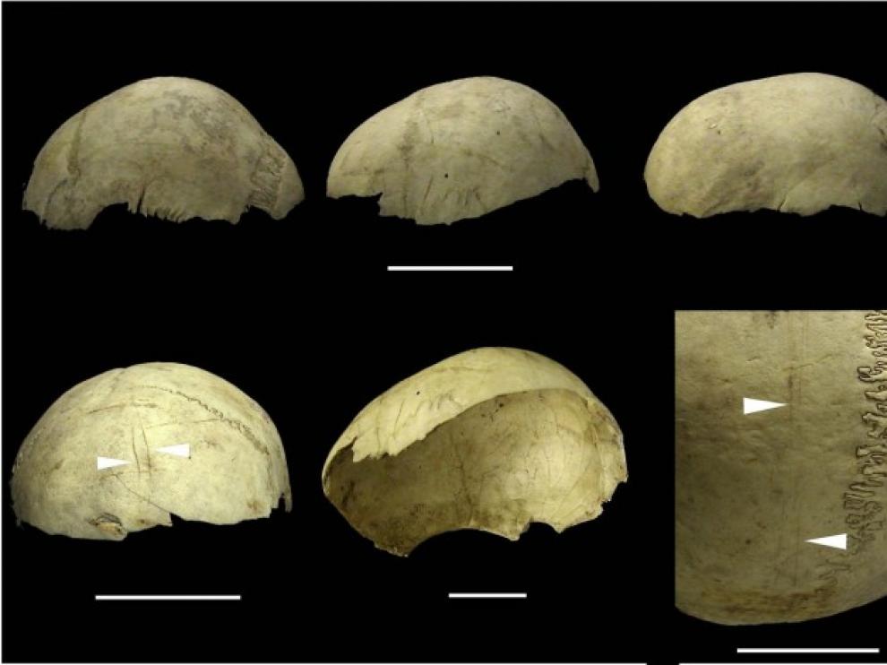 Los humanos emplearon cráneos para fabricar cuencos durante 15.000 años