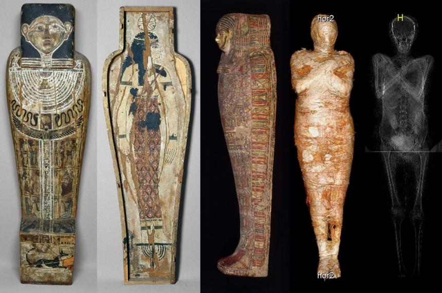 El Museo Nacional de Varsovia descubre que tiene la primera momia conocida de una mujer embarazada